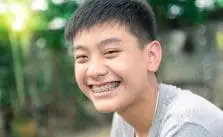 Different Types of Braces for Kids in Mesquite