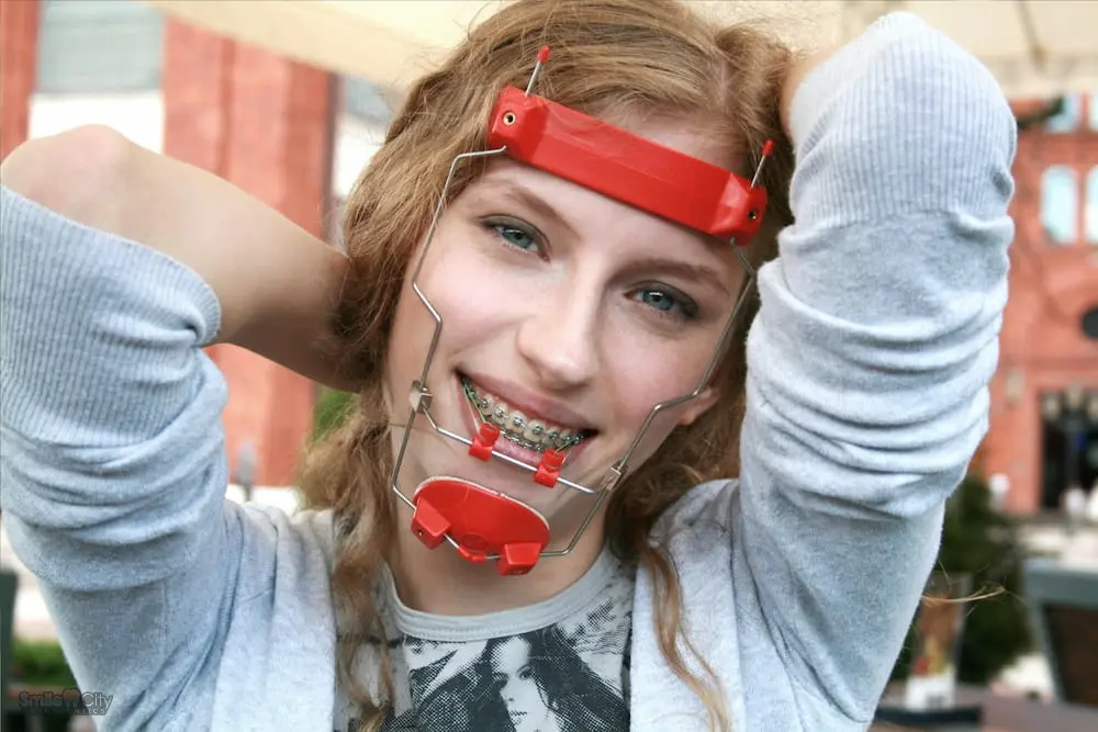 a woman posing at the camera wearing red reverse pull headgear braces in Sunnyvale, TX