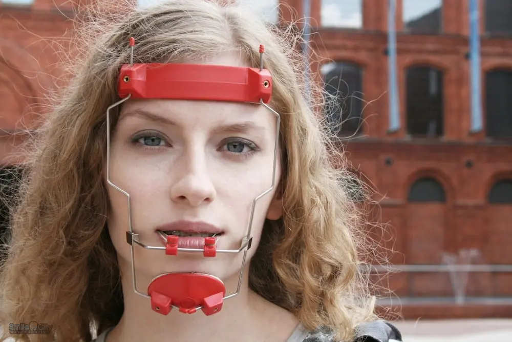 a woman looking at the camera wearing red reverse pull headgear braces in Sunnyvale, TX