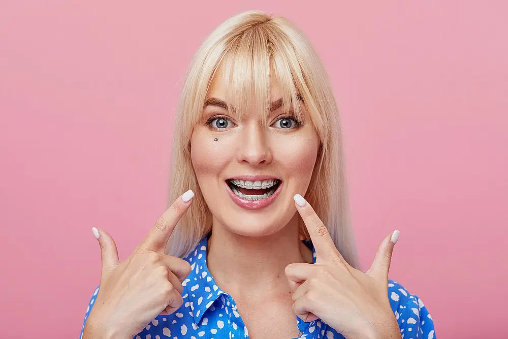 A smiling woman with blonde hair, wearing a blue patterned shirt, stands in front of a pink background and points to her braces—showcasing her radiant smile and the benefits of clear braces at Smile City Orthodontics in Sunnyvale, TX.