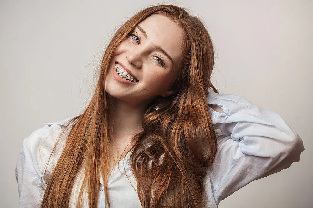 A young woman with long red hair, wearing a white shirt and clear braces, smiles in front of a plain background at Smile City Orthodontics in Sunnyvale, TX.
