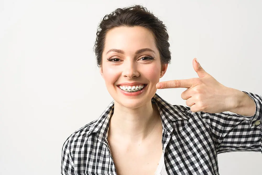 A woman wearing a black and white checkered shirt smiles and points to her dental braces, highlighting her adult braces at Smile City Orthodontics in Sunnyvale TX, against a plain white background.