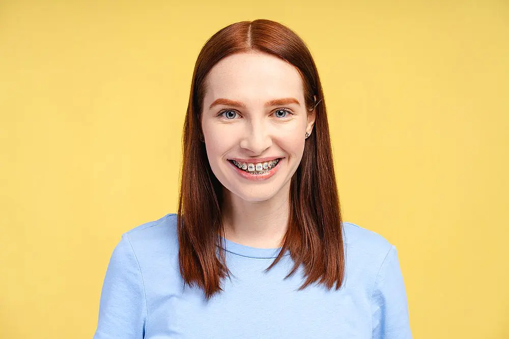 A young person with straight red hair, wearing a light blue shirt and metal braces, smiles at the camera against a yellow background at Smile City Orthodontics in Sunnyvale, TX.