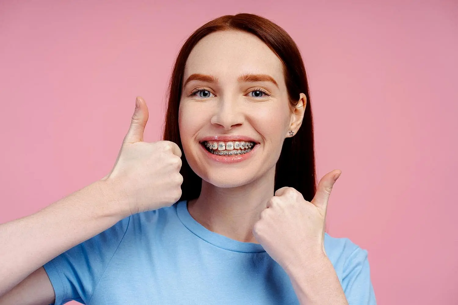 A young woman with long brown hair and metal braces flashes a smile and gives two thumbs up in front of a pink background while wearing a light blue shirt at Smile City Orthodontics in Sunnyvale, TX.