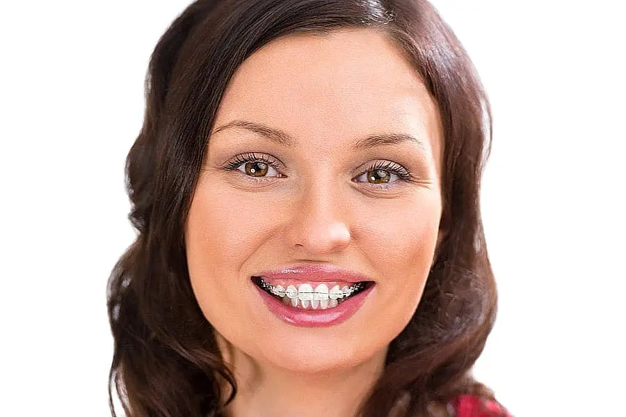 A woman with long brown hair smiles, displaying ceramic braces on her teeth against a white background—an ideal representation of ceramic braces available at Smile City Orthodontics in Sunnyvale, TX.