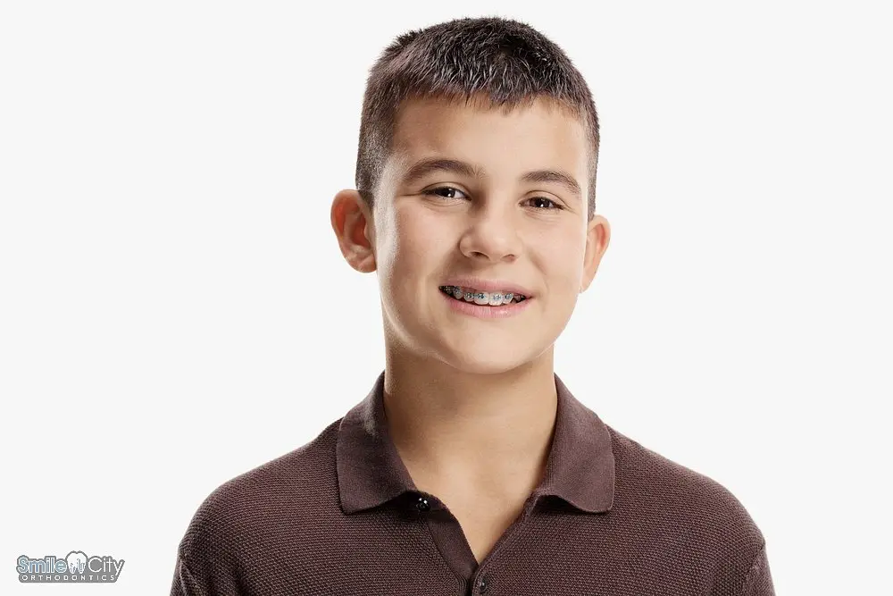 Smiling teenage boy with braces, showcasing progress in orthodontic braces for overbite in sunnyvale, tx.