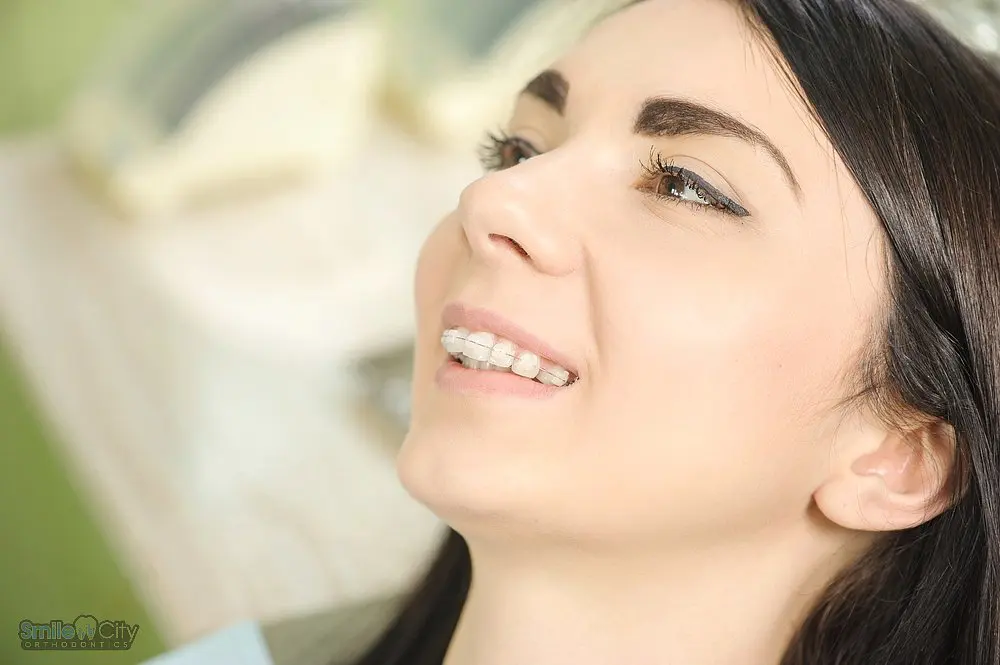 Close-up of a relaxed woman in a dental chair during her braces for overbite in sunnyvale, tx treatment.