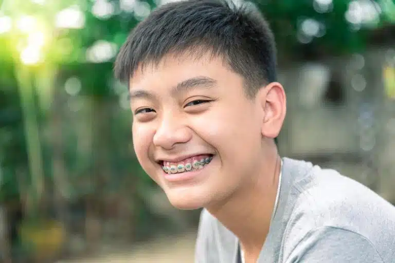 Different Types of Braces for Kids in Mesquite, Dr. Jacob, Sunnyvale and Mesquite, TX, Orthodontics