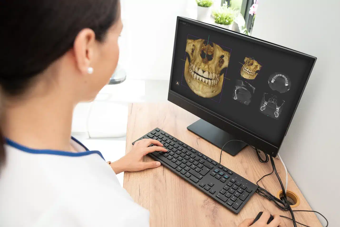 At Smile City Orthodontics in Sunnyvale, TX, advanced technology enables professionals to review 3D dental and skull scans on a computer for precise diagnostics.