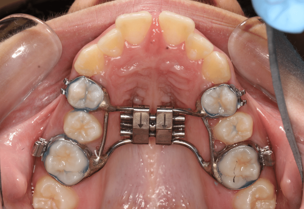 Smile City Orthodontics