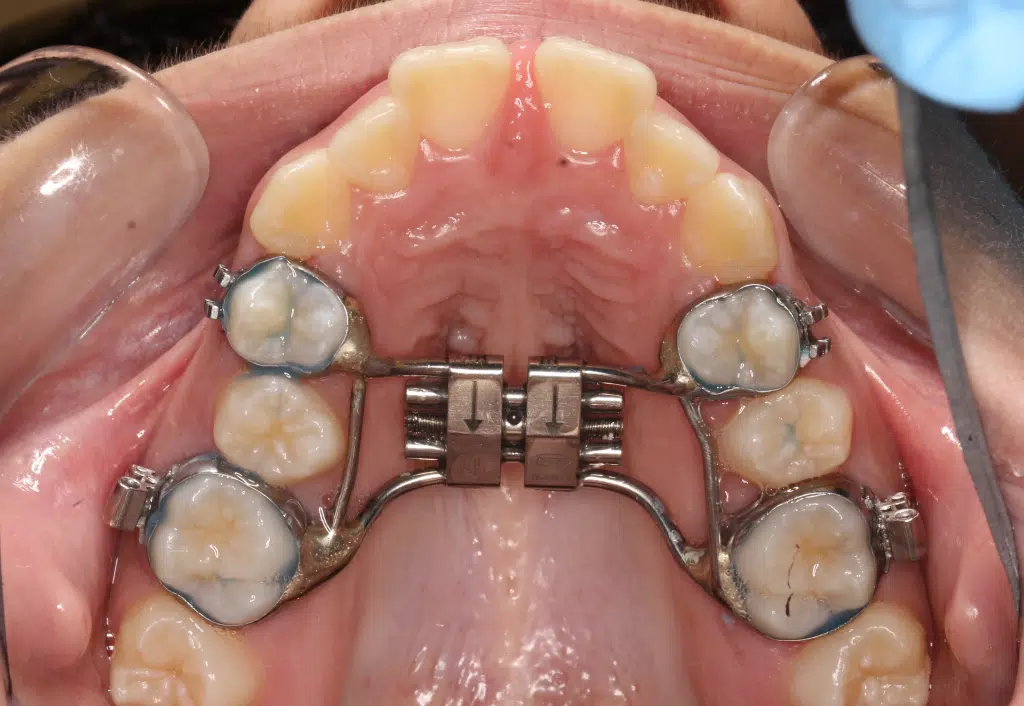 Smile City Orthodontics