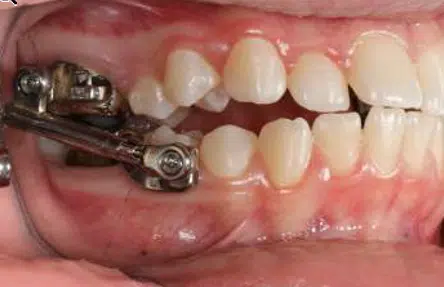 Orthopedic Treatment