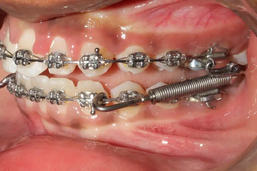 Orthopedic Treatment