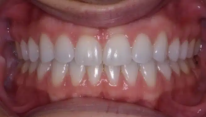 Smile City Orthodontics