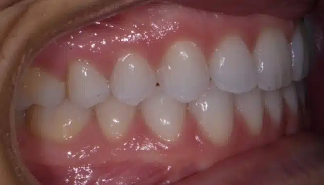 Smile City Orthodontics