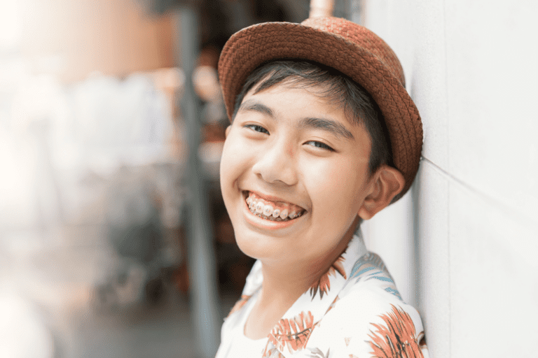 smile city orthodontics braces in mesquite, mesquite, garland texas area, Traditional Metal Braces in Sunnyvale and Mesquite Sunnyvale Traditional Metal Braces. SCO. Clear Aligners, Metal Braces, Ceramic Braces, Jaw Surgery in Sunnyvale, TX 75182. P:214-663-9144