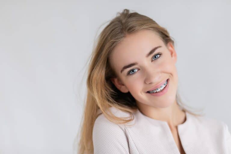 Braces for Teens Sunnyvale