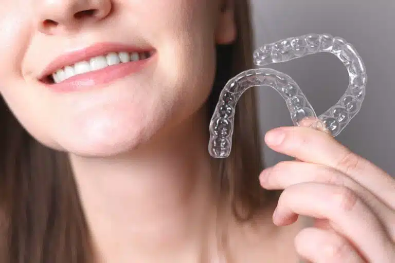 Clear Aligners Sunnyvale
