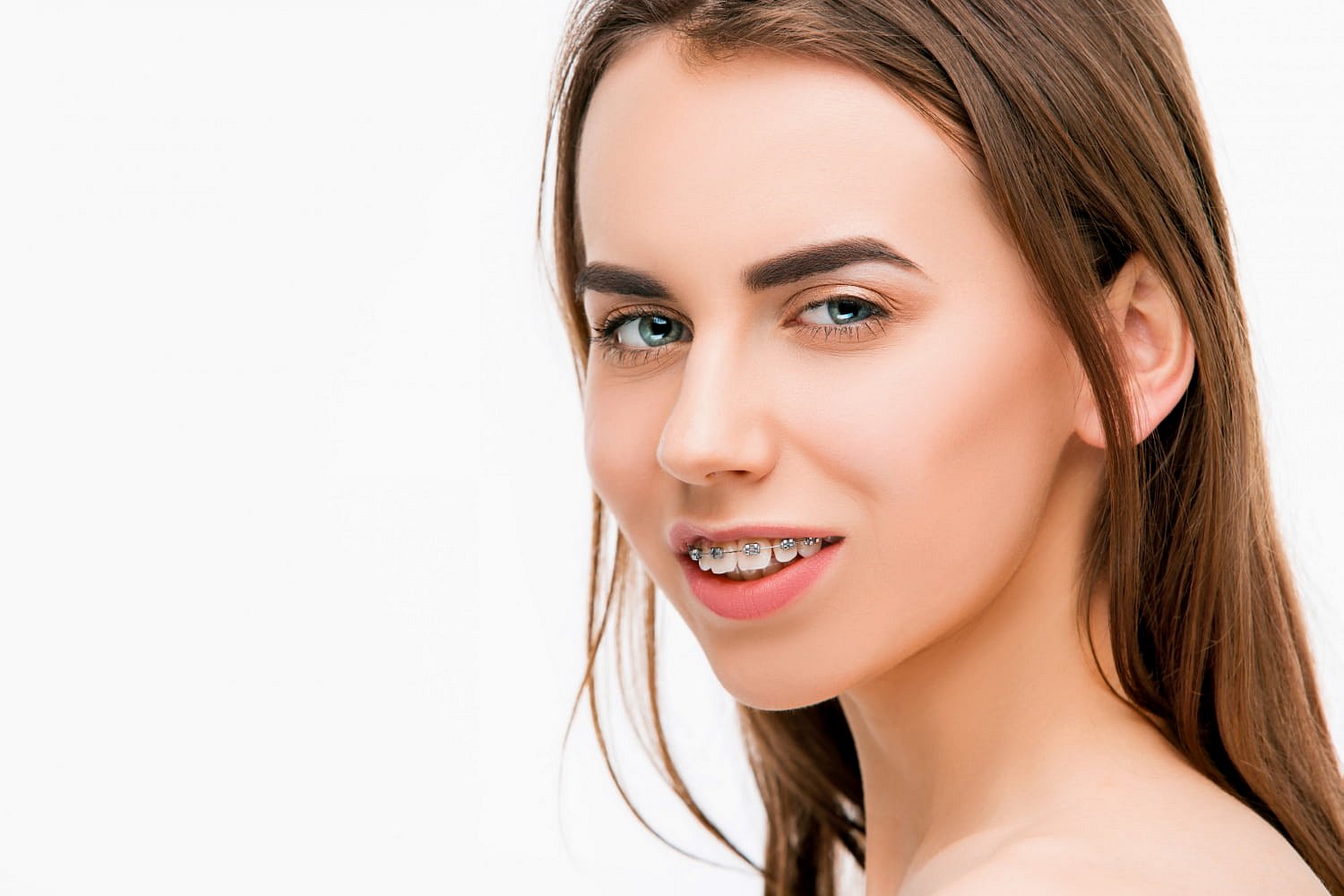 A young woman with long brown hair and braces, subtly showing an overbite as she smiles slightly at the camera, represents Smile City Orthodontics in Sunnyvale, TX.