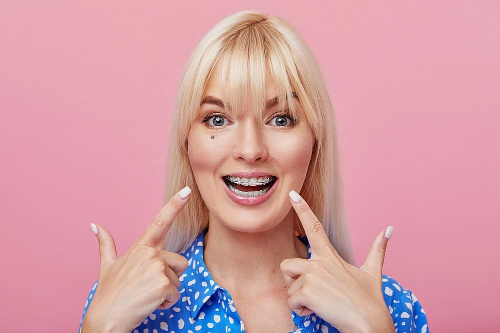 Smile City Orthodontics A smiling woman with blonde hair, wearing a blue patterned shirt, stands in front of a pink background and points to her braces—showcasing her radiant smile and the benefits of clear braces at Smile City Orthodontics in Sunnyvale, TX.