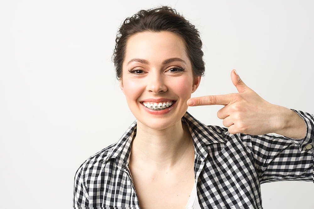 A woman wearing a black and white checkered shirt smiles and points to her dental braces, highlighting her adult braces at Smile City Orthodontics in Sunnyvale TX, against a plain white background.