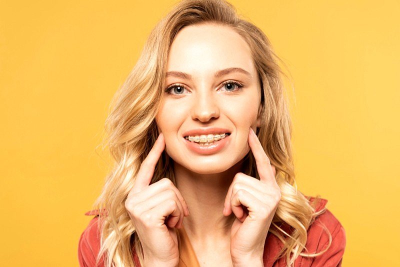 At Smile City Orthodontics in Sunnyvale TX, a young blonde woman stands against a yellow background, smiling and pointing to her clear braces.