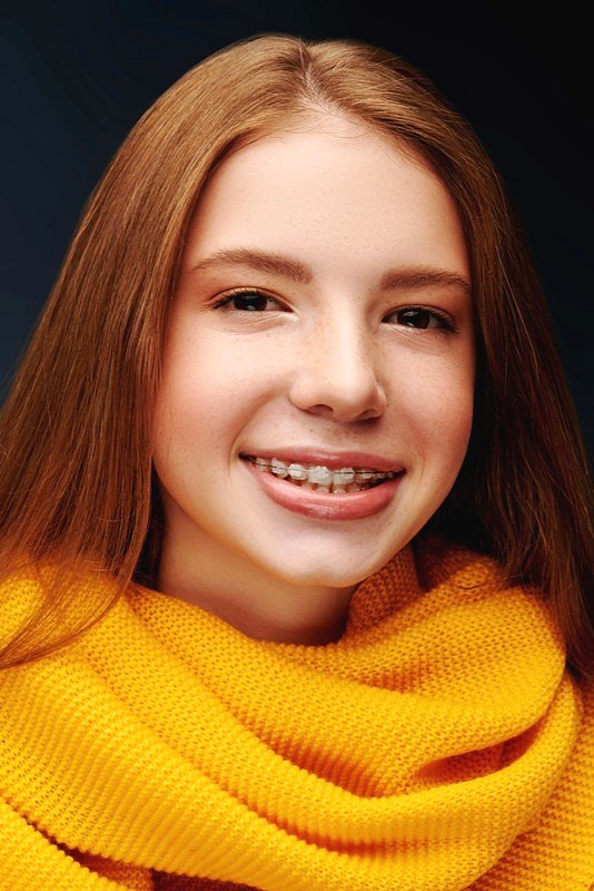 A teen girl with long straight hair, wearing a yellow knit scarf, smiles and shows off her clear ceramic braces at Smile City Orthodontics in Sunnyvale TX, set against a dark background.