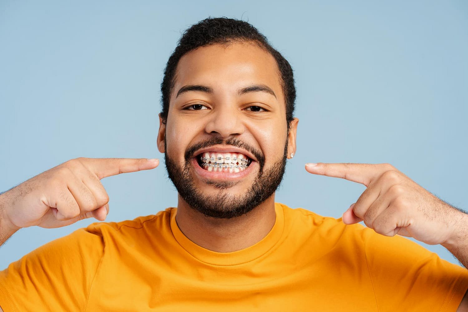 A man in a yellow shirt with metal braces smiles and points to his teeth against a blue background, representing Smile City Orthodontics in Mesquite, TX.