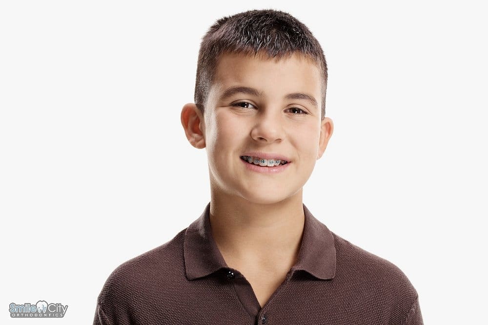 Smiling teenage boy with braces, showcasing progress in orthodontic braces for overbite in sunnyvale, tx.