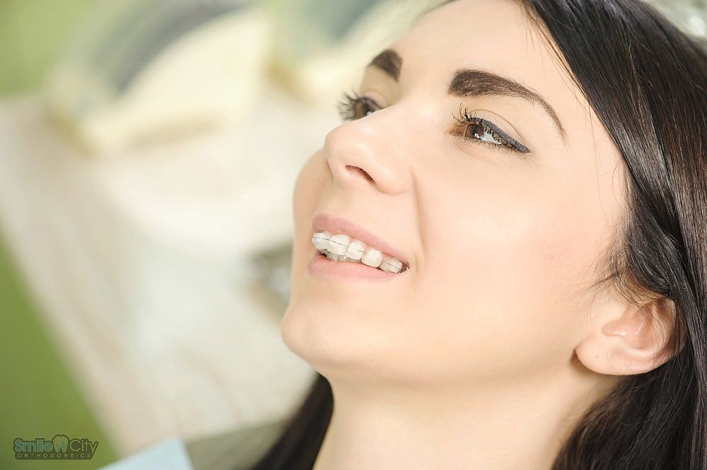 Close-up of a relaxed woman in a dental chair during her braces for overbite in sunnyvale, tx treatment.