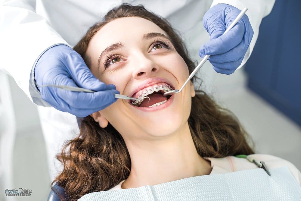 cropped view dentist latex gloves examining cheerful woman metal braces opened watermark - how long do braces take in Sunnyvale, TX. 