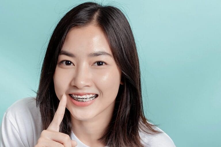 dental braces young asian woman wearing metal braces beauty smile - how long do braces take in Sunnyvale, TX.