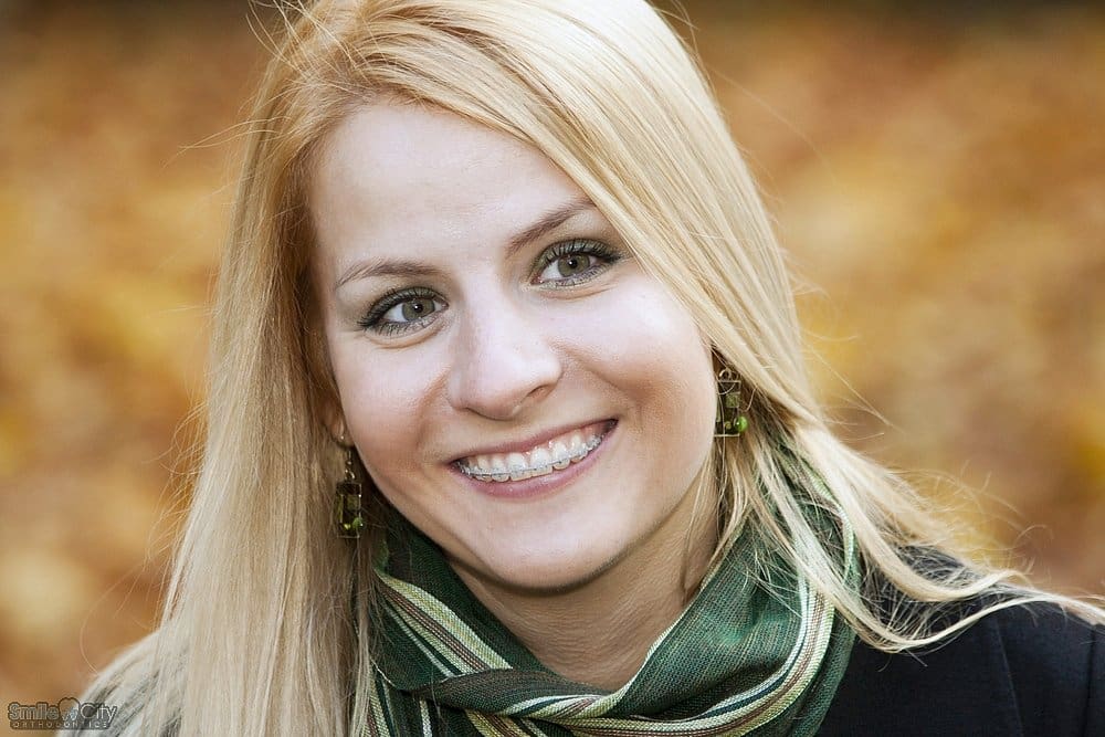 smiling blonde young woman with clear braces - Clear Braces vs Metal Braces in Sunnyvale, TX
