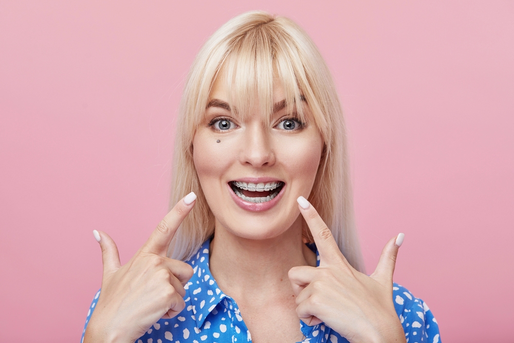 cheerful happy young woman blonde hair gesturing thumb while pointing clear braces - How to Clean Braces: The Routine That Actually Protects Your Teeth in Sunnyvale TX