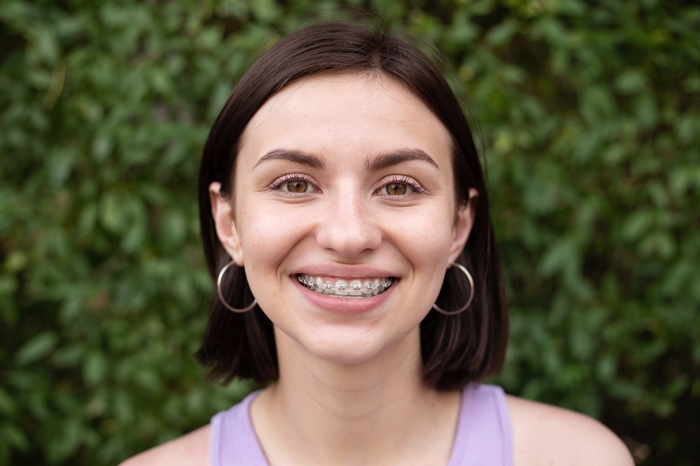 How Long Does It Take To Get Used To Braces? A Week-by-Week Breakdown